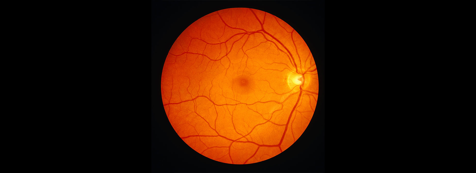 retinal-image